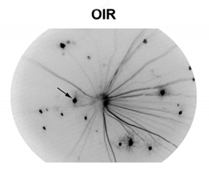 Image of RGC in an OIR mouse retina