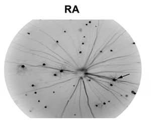 Image of RGC in normal room air mouse retina