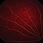 mCherry retinal image