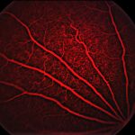 mcherry-retinal-image-Phoenix-MICRON-IV