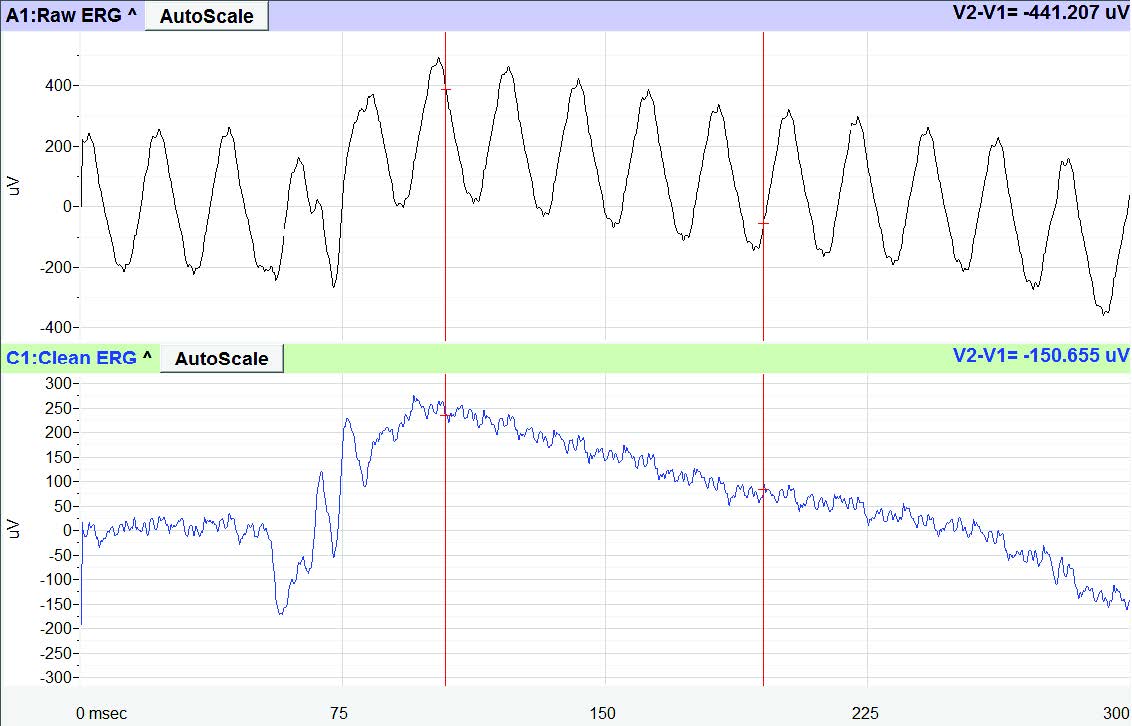 ERG Clean software