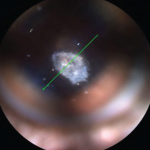 fundus retinal image