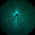 Mouse-GFP-Cyan