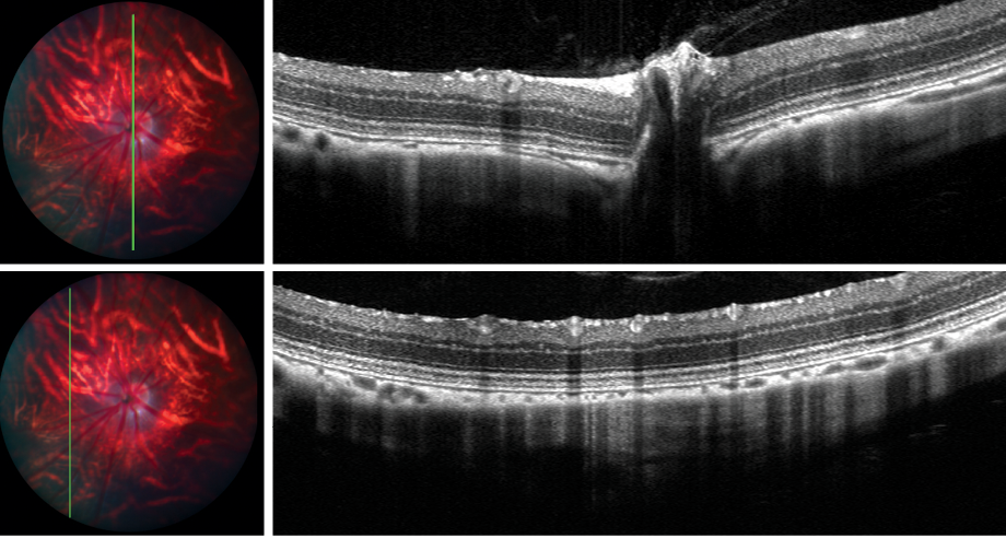 OCT scans and live fundus positioning shots