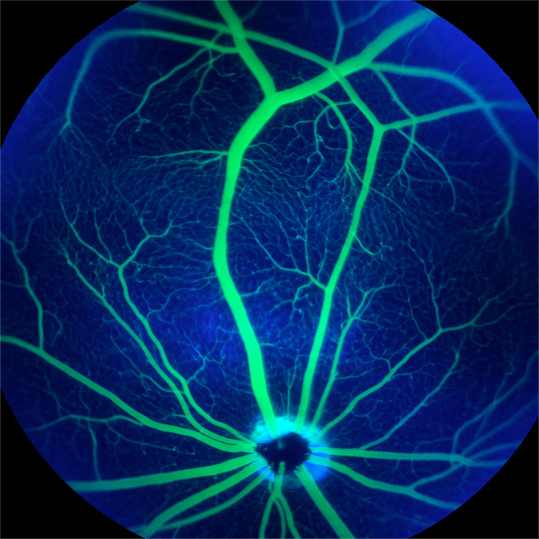 Rodent Fluorescent Angiography retinal image