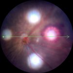 Phoenix-MICRON-X-retinal-image-pig-laser-oct