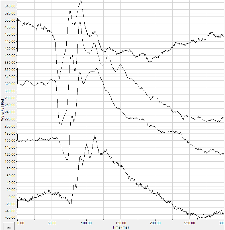 ERG waterfall graph