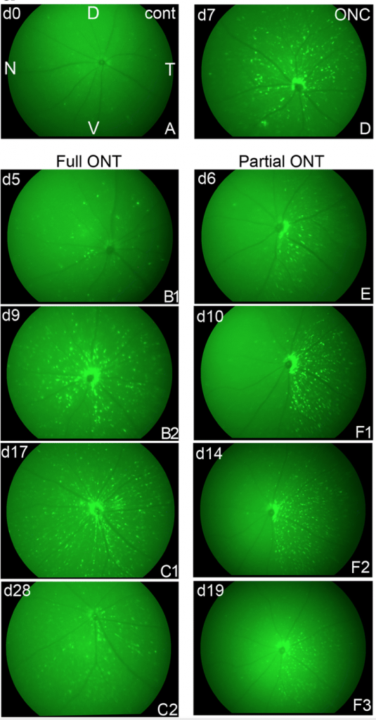 GFP-fluorescence fundus imaging of mouse
