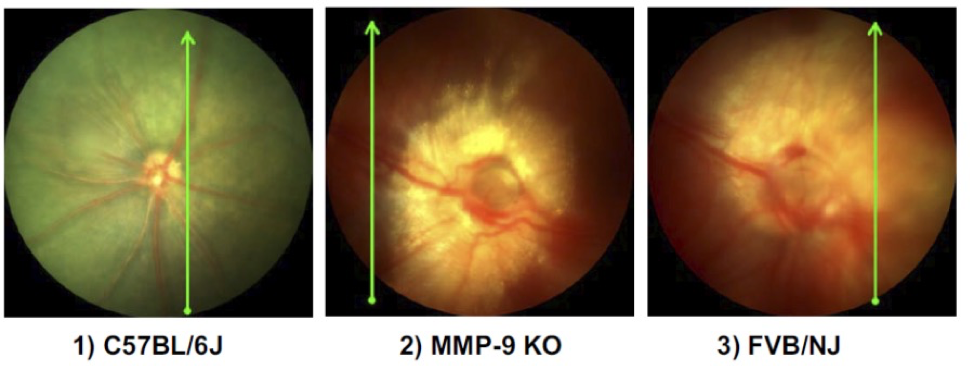 Noninvasive in vivo imaging of the retinal microvasculature by Phoenix MICRON<span class=