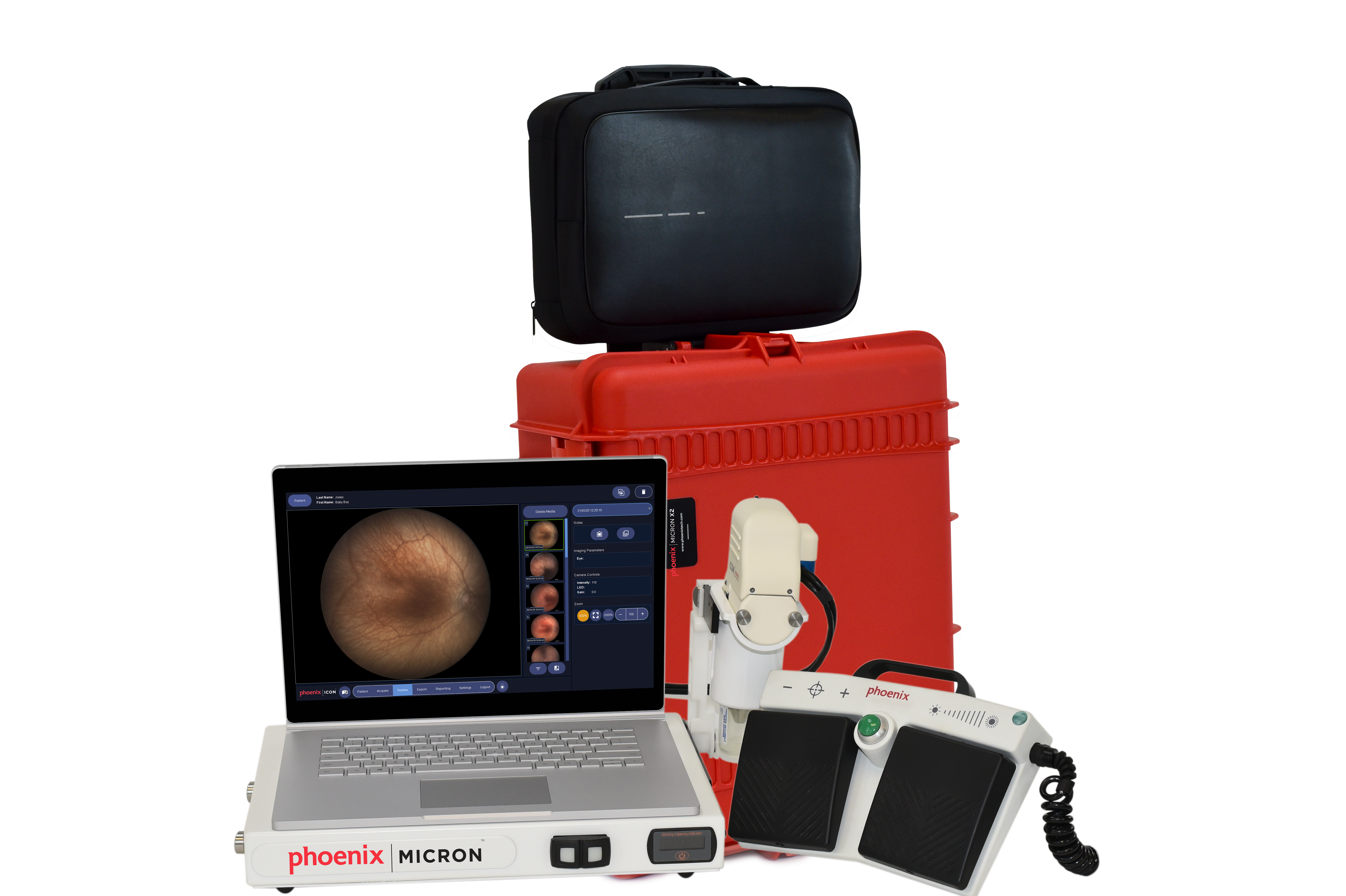 Micron X2 portable retinal camera for animals
