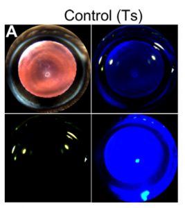 red reflex and cobalt blue slit lamp images of lens and cornea