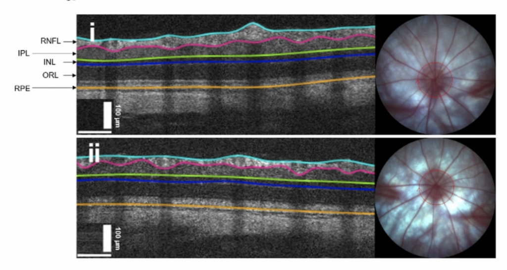 Retina OCT and bright field images