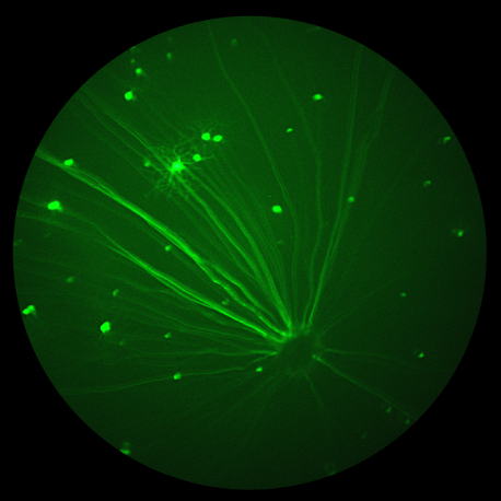 4_GFP