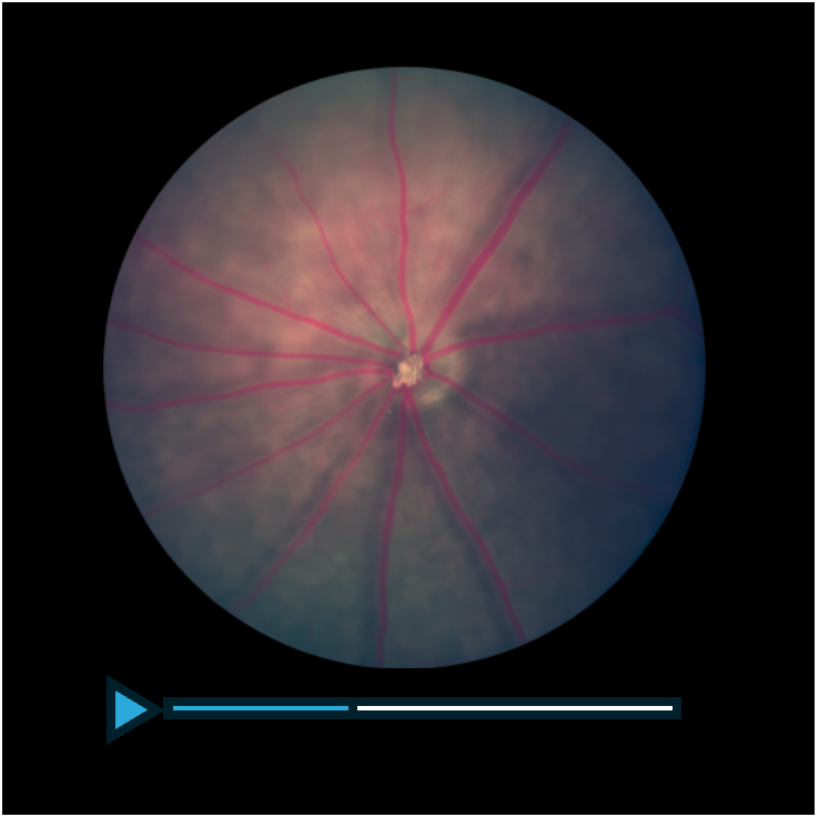 Capture hi-res still images and videos with real-time fundus viewing