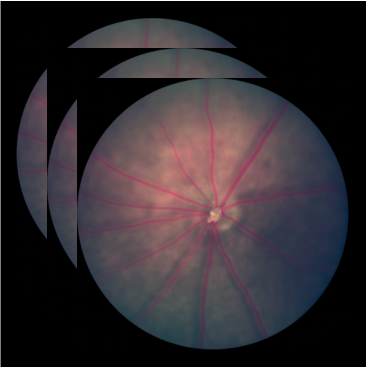 Extract still images from videos for detailed analysis 